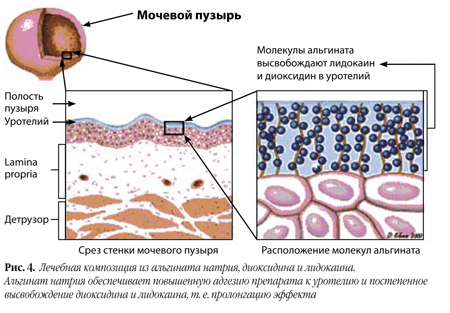 Шеечный цистит у женщин. Переходный эпителий мочевого пузыря гистология. Эпителий мочевого пузыря гистология. Оболочки мочевого пузыря гистология. Переходный эпителий мочевого пузыря препарат.